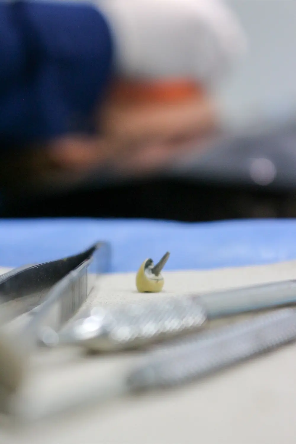 Primer plano de un implante dental